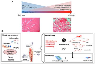 Combined Therapies for Duchenne Muscular Dystrophy to Optimize Treatment Efficacy